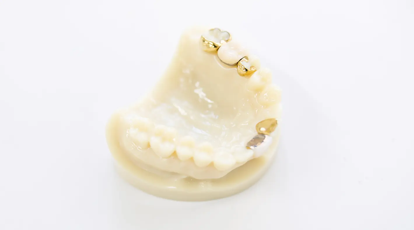 ヒューマンブリッジ