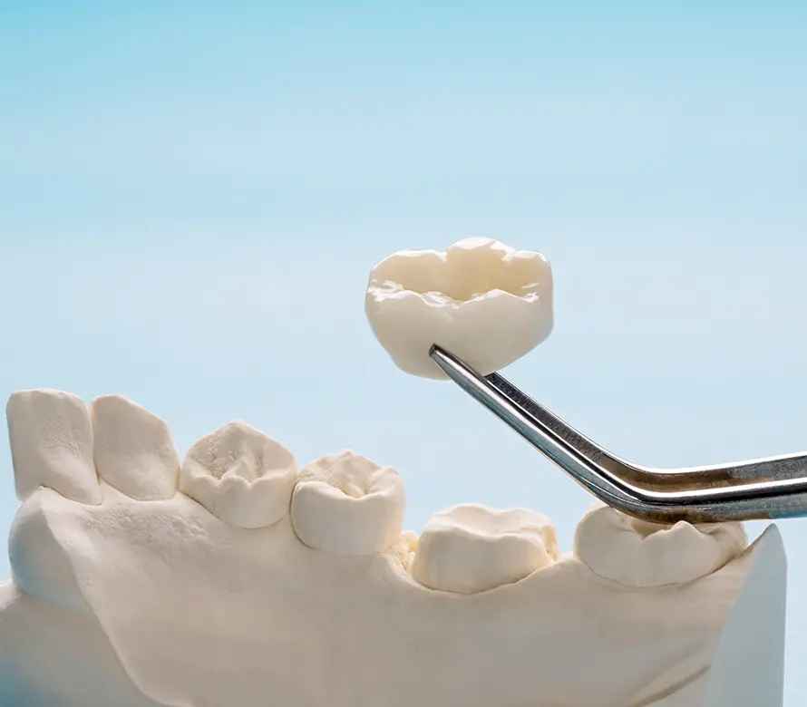 審美・セラミック治療